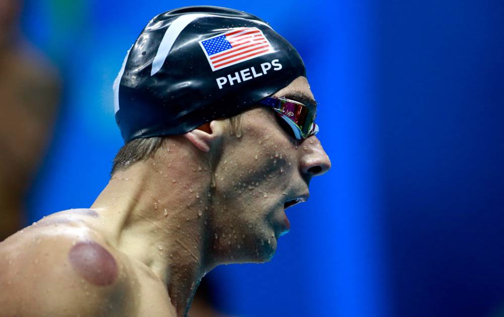 Como calman atletas sus dolores en Juegos de Río