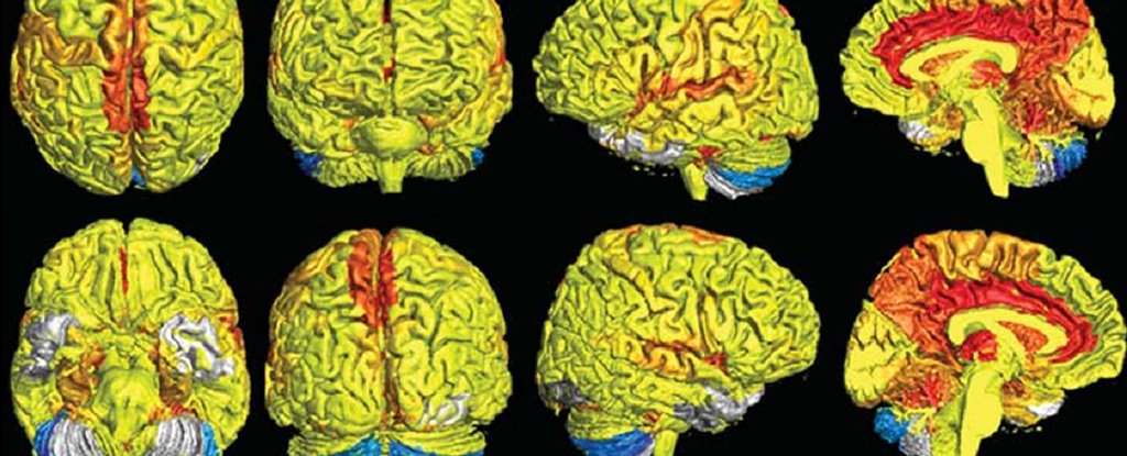 Científicos descubren una nueva diferencia entre el hombre y la mujer