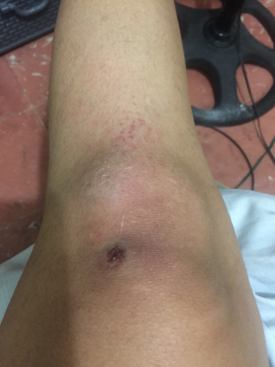 Una periodista forcejea con individuo intentó atracarla