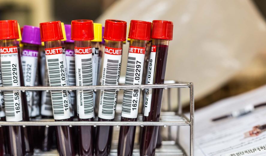 El cáncer de próstata, pulmón y ovario ya se puede detectar mediante muestras de sangre y orina