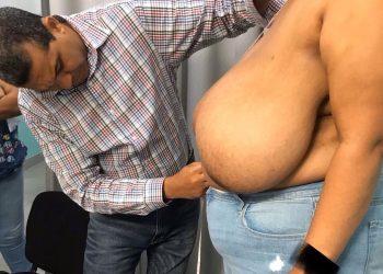 Doctor Orlando Vargas Almonte evalúa pacientes para jornada  quirúrgica a mujeres con gigantomastia
