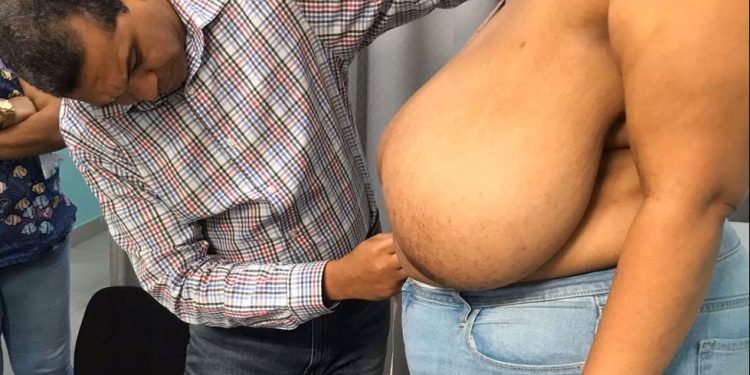 Doctor Orlando Vargas Almonte evalúa pacientes para jornada  quirúrgica a mujeres con gigantomastia