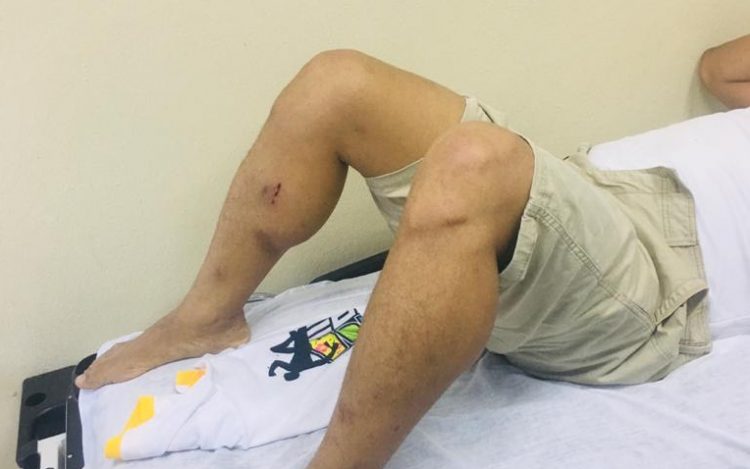 Agreden en Nagua a comunicador y dirigente del PLD