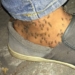Mosquitos atacan residentes en Cabral, Barahona