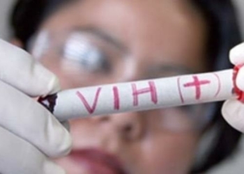 Encuesta revela estragos de la pandemia en la economía de los VIH-positivos