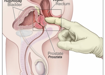 Grupo Urus realizará  jornada de “Detección Temprana de Cáncer de Próstata”