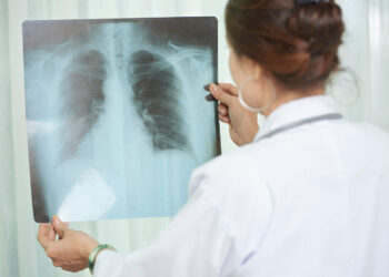 Clave en tuberculosis es detección temprana, asegura especialista