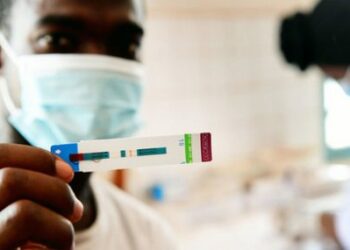 ONU con nuevo decálogo contra el VIH/sida  que generó 1,7 millones de infecciones en 2019