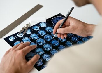 Conozca como pacientes con Esclerosis Múltiple pueden generar anticuerpos contra la Covid