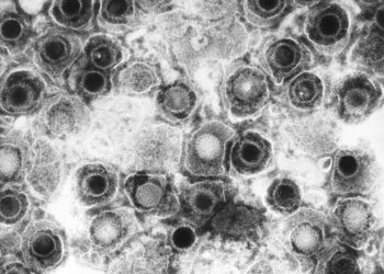 Encuentran pruebas de la posible relación entre el herpes simple y las enfermedades neurodegenerativas