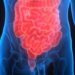 Un estudio confirma que los antibióticos aumentan el riesgo de cáncer de colon