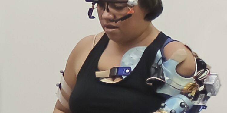 Brazo biónico recupera el control natural de los pacientes con amputaciones de miembros superiores