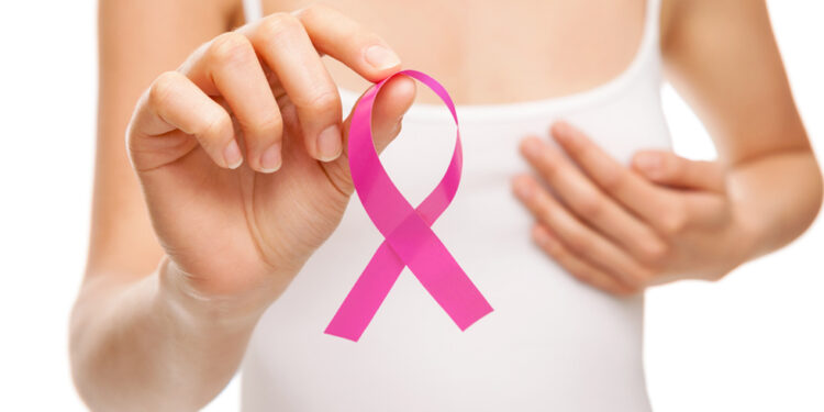 El cáncer de mama es el tipo de cáncer más común, con más de 2,2 millones de casos en 2020