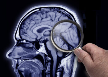 Estudio revela terapia génica con "dedos de cinc" es efectiva para tratar el Alzheimer