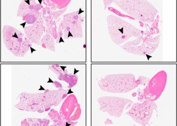 Un nuevo enfoque terapéutico podría impedir la reaparición de varios tipos de cáncer