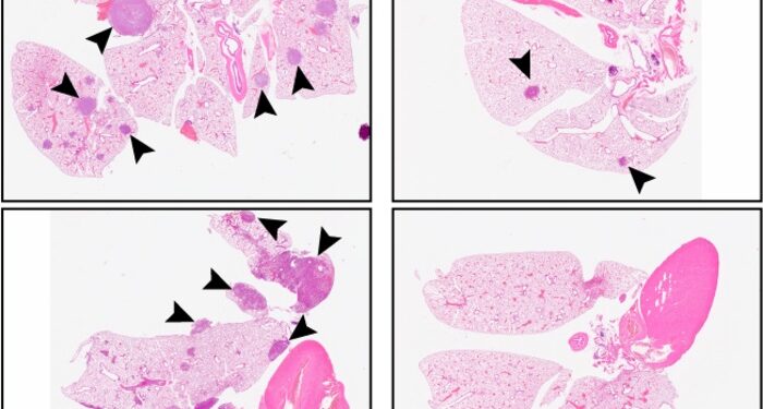 Un nuevo enfoque terapéutico podría impedir la reaparición de varios tipos de cáncer