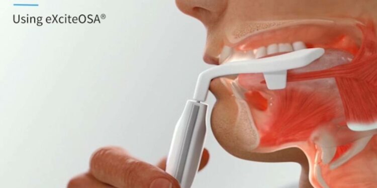 Estudio recomienda el uso un dispositivo dental para los ronquidos