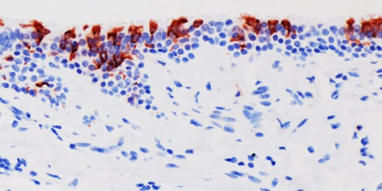 Descubren que ómicron infecta y se multiplica 70 veces más rápido que la variante Delta