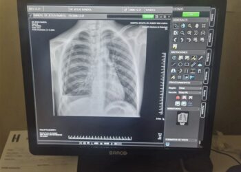 El Robert Reid Cabral actualiza sus servicios de radiología