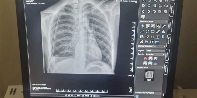 El Robert Reid Cabral actualiza sus servicios de radiología