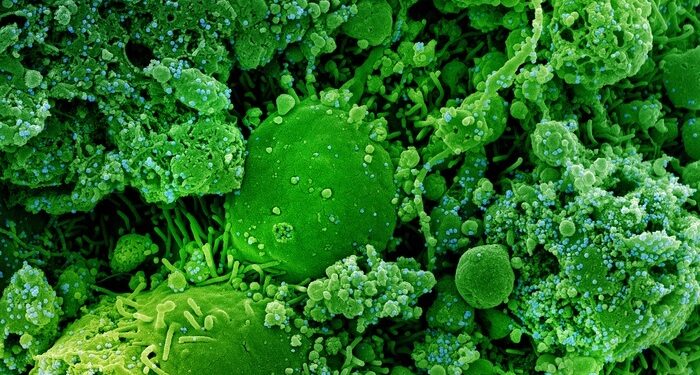 La infección protege hasta un 86% del riesgo de volver a ser positivo en COVID-19