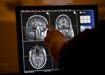 Los riesgos del síndrome metabólico en pacientes hospitalizados por COVID-19