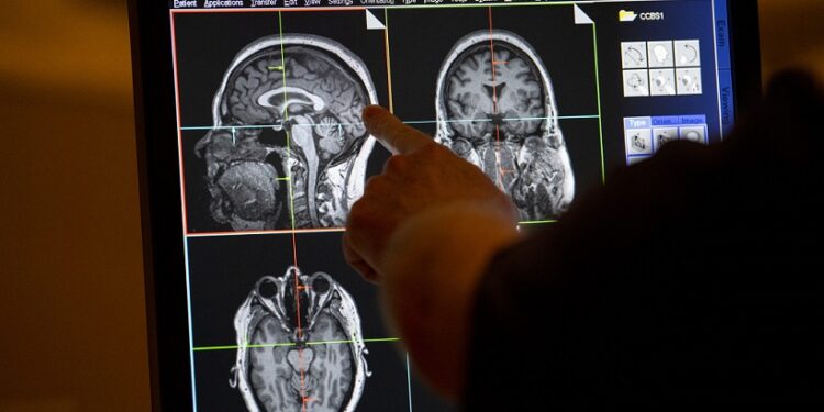 Los riesgos del síndrome metabólico en pacientes hospitalizados por COVID-19