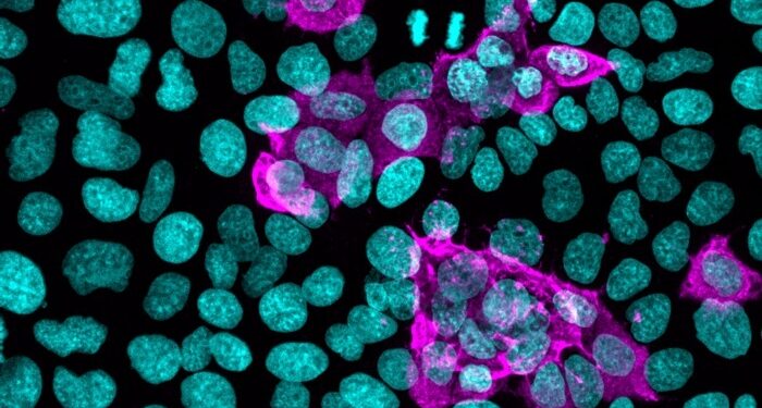 Haberse infectado antes de la primera dosis mejora la respuesta inmunitaria contra la COVID-19