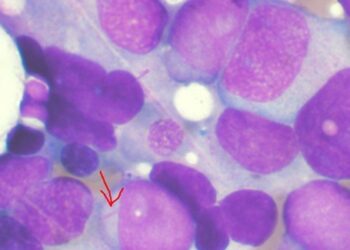 Un estudio sugiere que el cáncer no tiene tanto componente genético como se pensaba