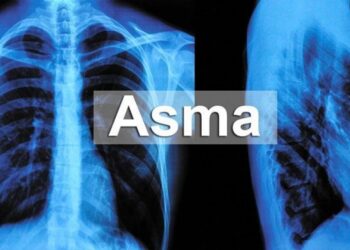 Personas con asma alérgica son menos susceptibles de sufrir COVID-19 grave