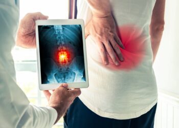 El ibuprofeno es más efectivo en el dolor de espalda que el paracetamol, según un estudio