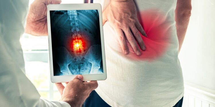 El ibuprofeno es más efectivo en el dolor de espalda que el paracetamol, según un estudio