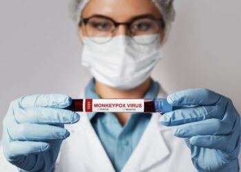 Brasil confirma la primera muerte por viruela del mono