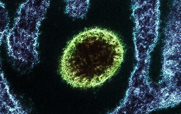 Un nuevo virus zoonótico ha infectado a 35 personas en dos provincias chinas