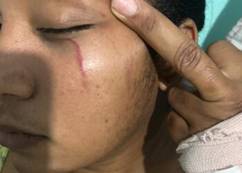 Informan miembros de la DIGESETT propinan golpiza a una joven en Boca Chica 