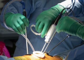 Realizan en el país primera cirugía de escoliosis sin abrir al paciente y con novedoso dispositivo