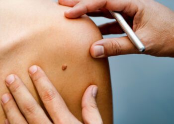 Startup lanza aplicación identifica enfermedades cutáneas a partir de una foto