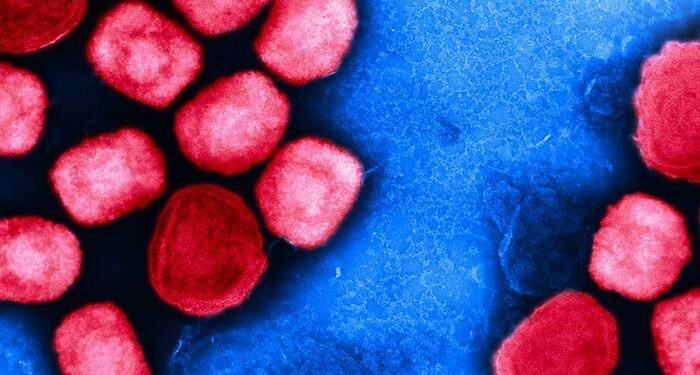 Identifican las mutaciones de la viruela del mono que hacen al virus infeccioso