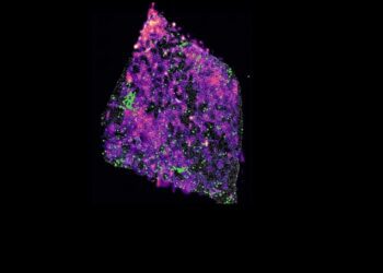 Algunos cánceres desactivan el sistema inmune y crecen sin control