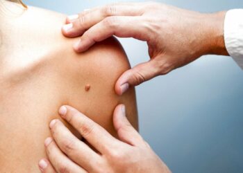 Dermatólogos denuncian colegas médicos por pisar su terreno