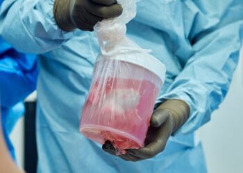 Importante avance médico al trasplantar un riñón de cerdo modificado genéticamente