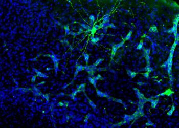 Descubren tumores cerebrales alteran comunicación neuronal