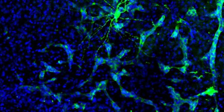 Descubren tumores cerebrales alteran comunicación neuronal