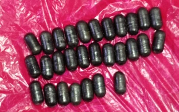 Otro extranjero llega de urgencia a hospital con presunta droga en el estómago