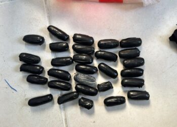 Extranjero acude de emergencia a hospital y le encuentran cocaína en el estómago