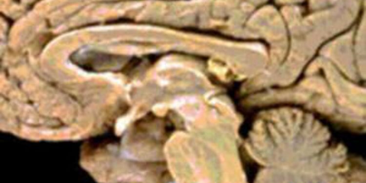 Descubrimientos revolucionarios: Investigadores publican un atlas detallado del cerebro humano