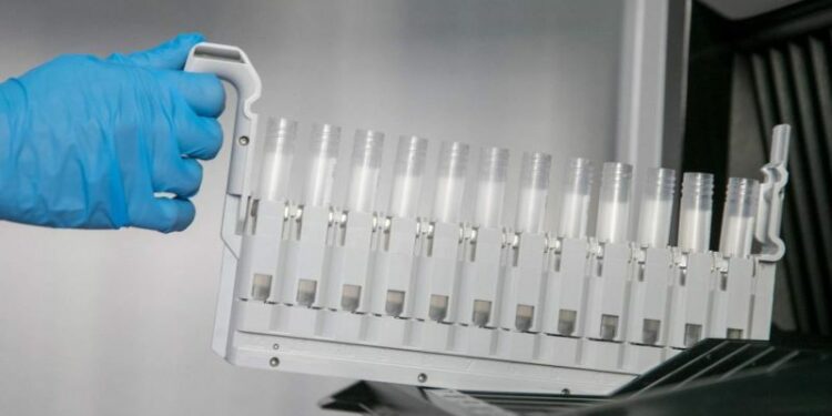 Descubrimiento de mecanismos genéticos que impulsan la evolución de la leucemia