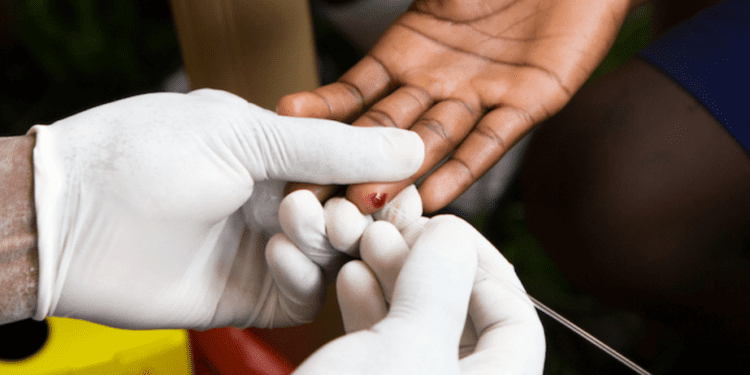 En República Dominicana residen cerca de 80 mil personas con VIH