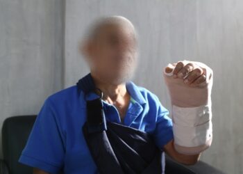 Paciente se recupera tras exitosa reconstrucción de mano en el Gautier