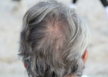 La revolución de las canas: ¿adiós al cabello gris?
